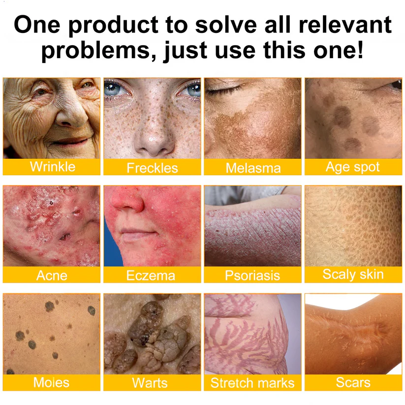 Enjoy 30% OFF for adding the second one🧡